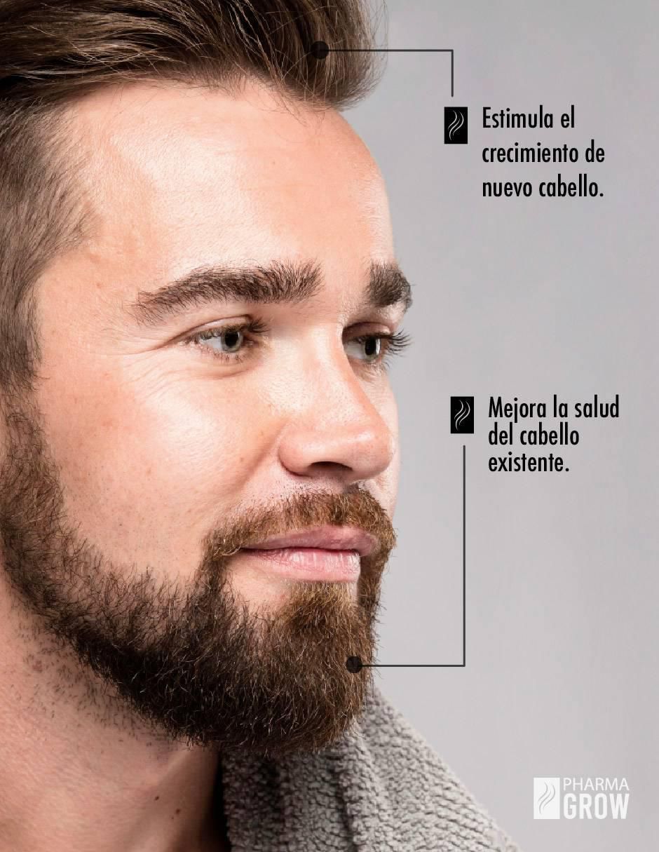 Minoxidil 5 mg de 30 cápsulas 5
