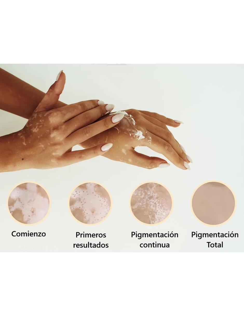 Corrector Repigment12 3