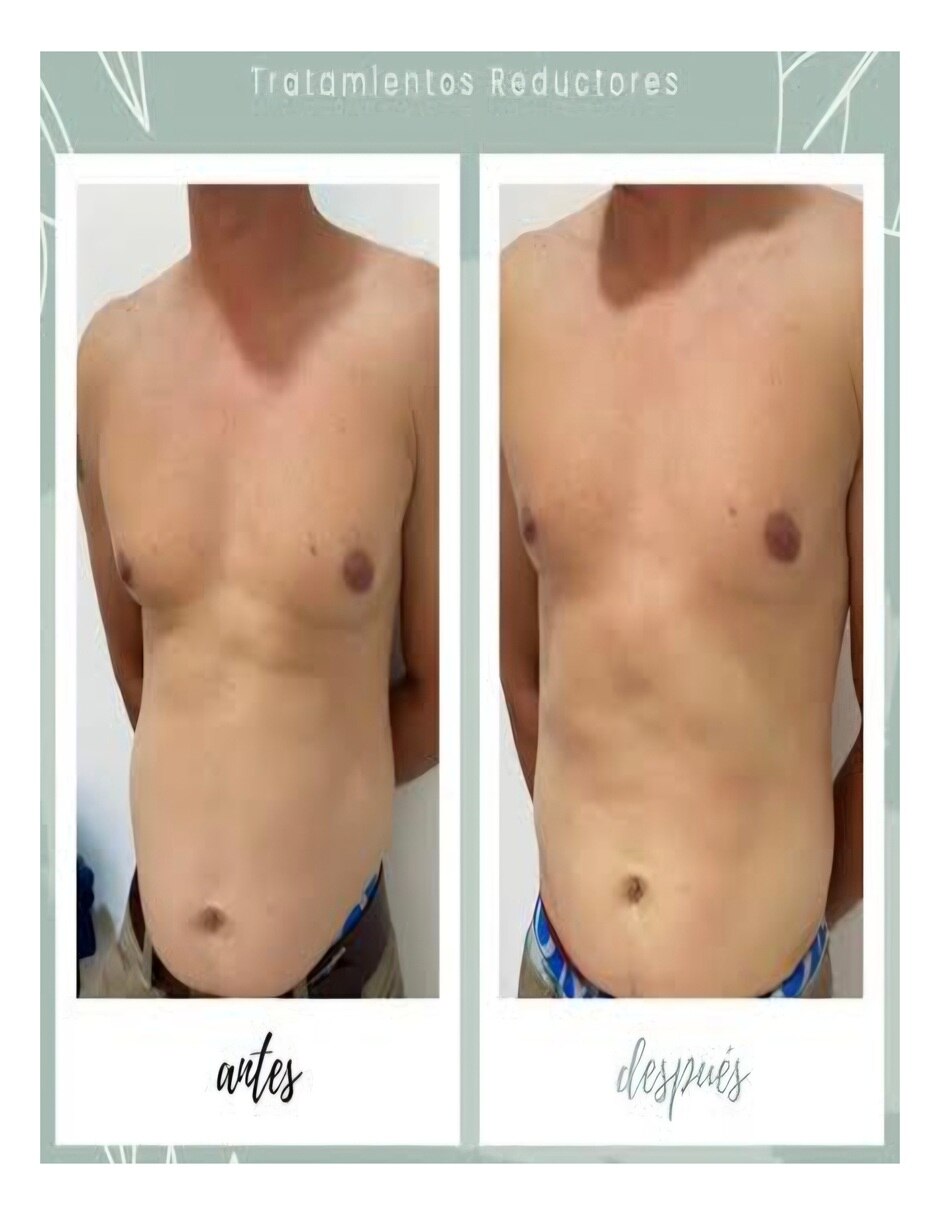 Kit Reductor Abdominal NATURE LIFE con Multivitaminico sabor No saborizado de