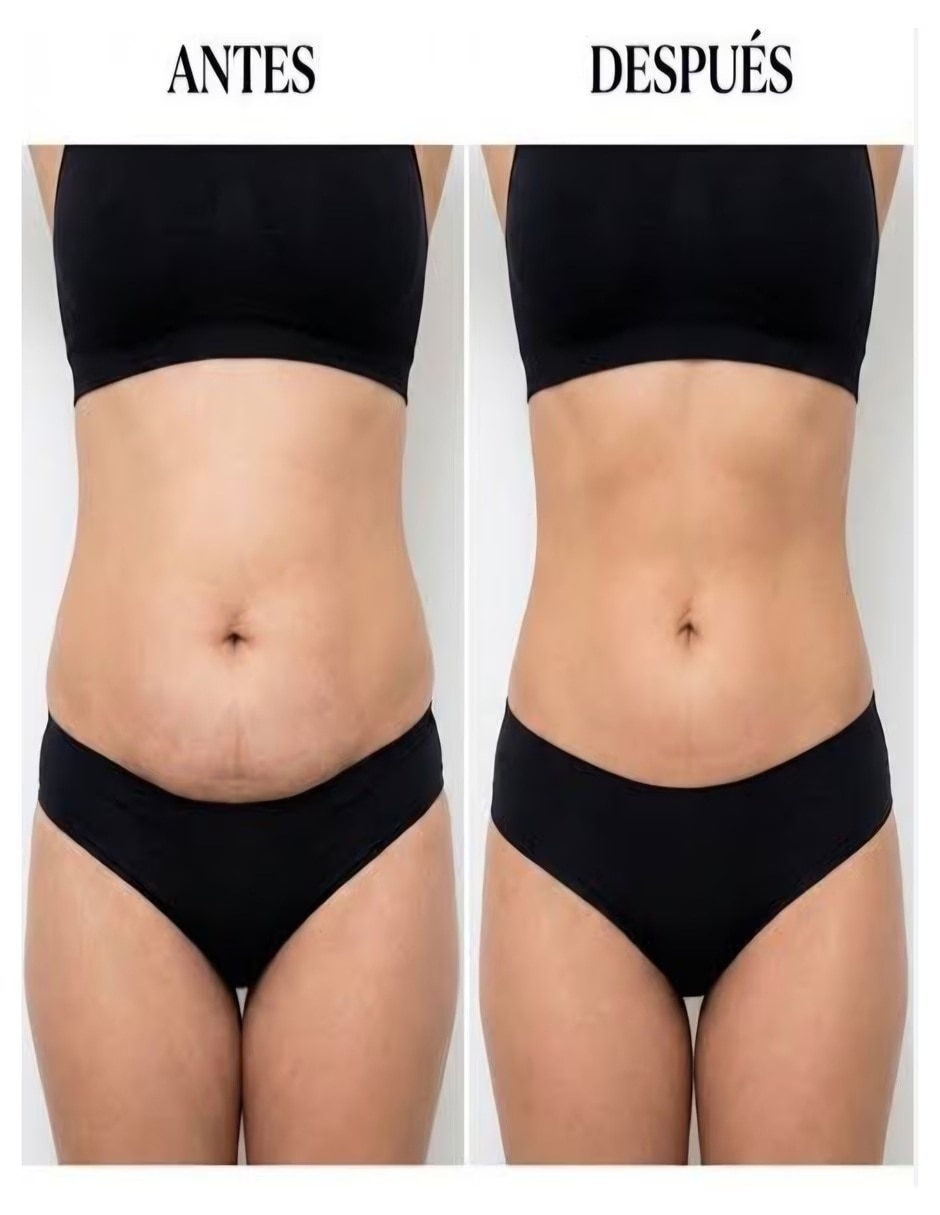 Kit Reductor Abdominal NATURE LIFE con Multivitaminico sabor No saborizado de