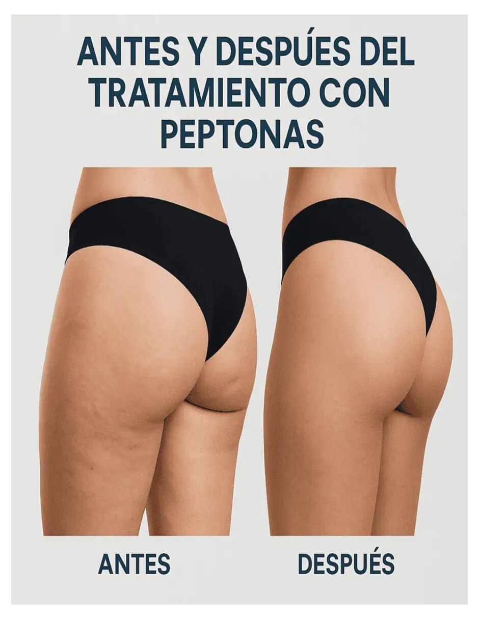 Kit Creatina Gluteo + Peptonas con multivitaminico 3