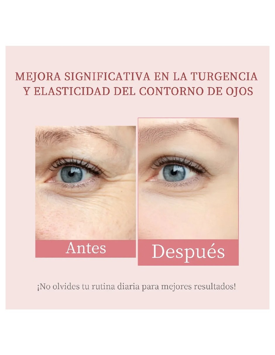 Crema para contorno de ojos recomendada para Bolsas y ojeras Día y noche Genérica todo tipo piel