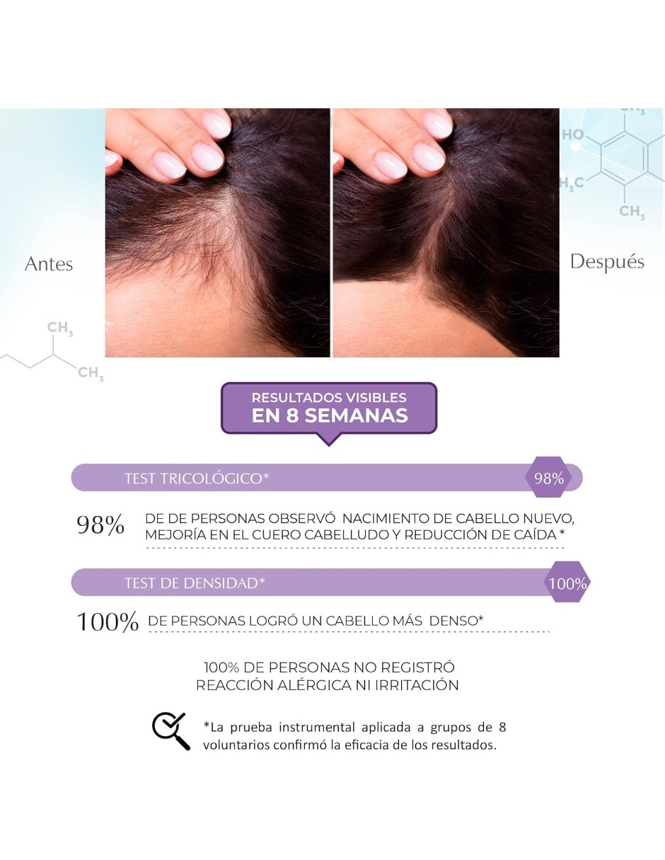 Set de shampoo para cabello todo tipo Science Advance 3