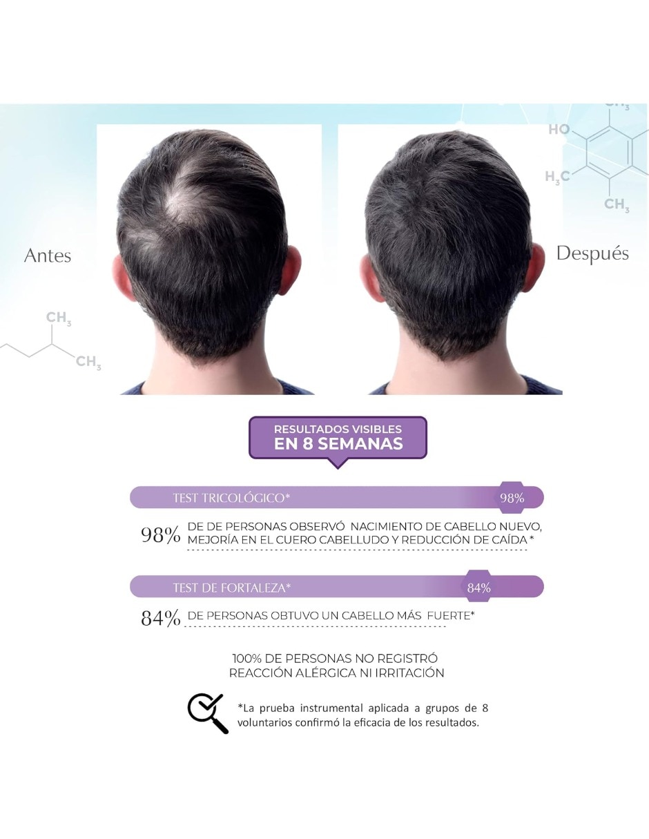Set de shampoo para cabello todo tipo Science Advance 6