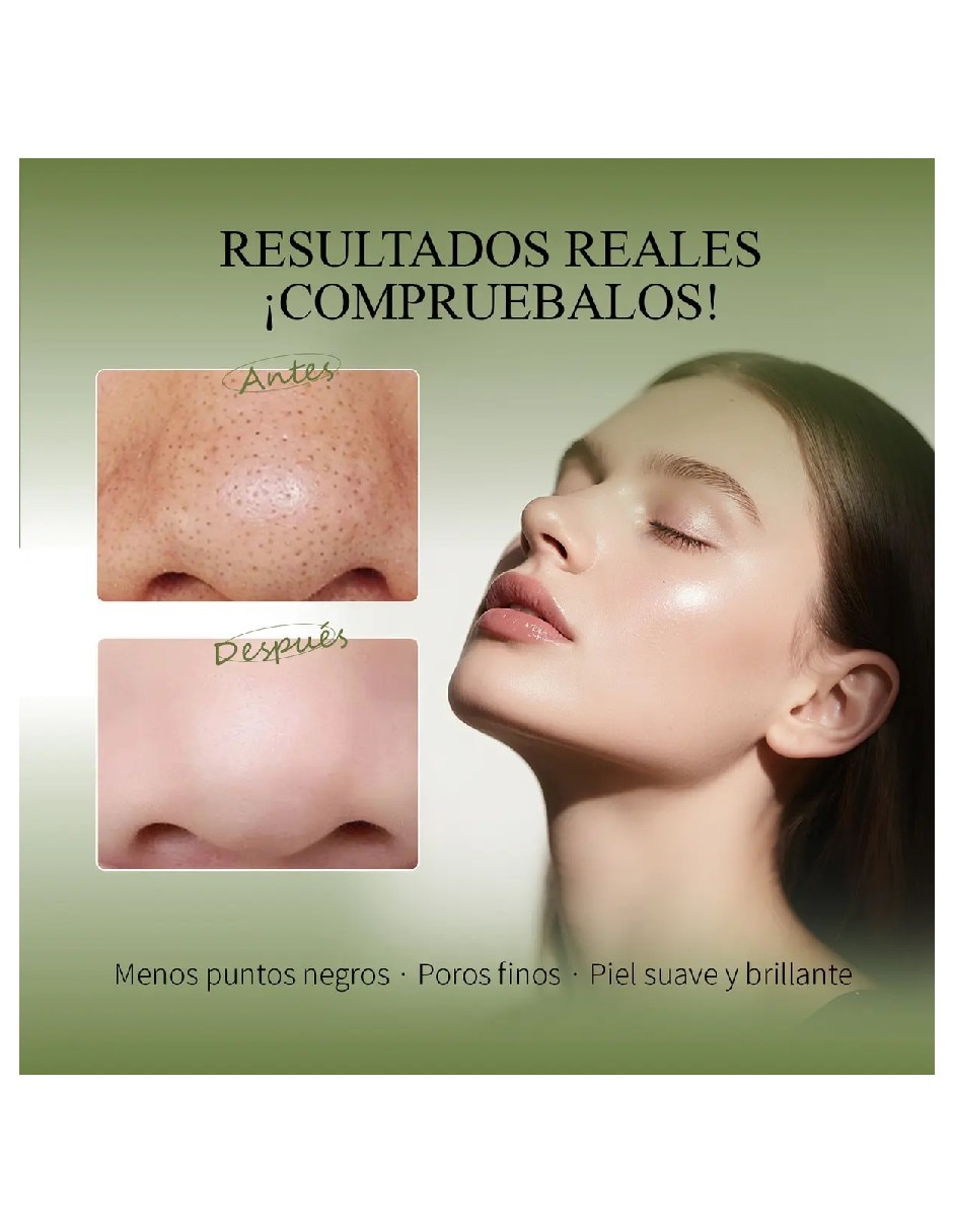Mascarilla facial kit mascarilla removedora de puntos negros + papel absorvente para acné Genérica