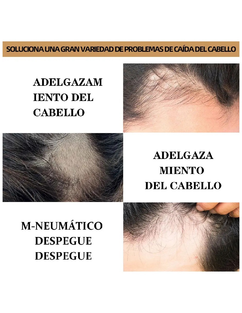 Sérum capilar para cabello minoxidil 5% anticaída Genérica todo tipo de piel