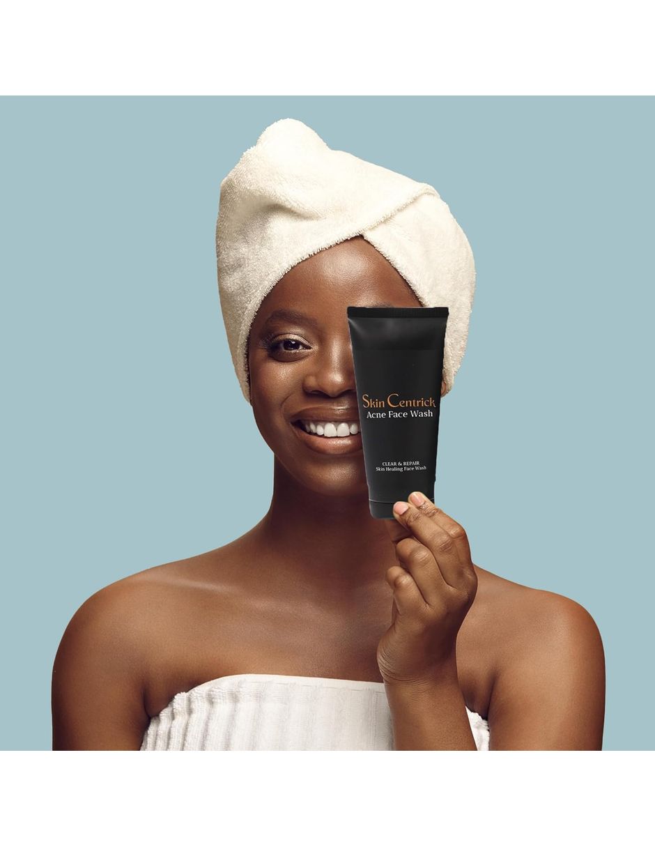 Limpiador facial para el acné 3