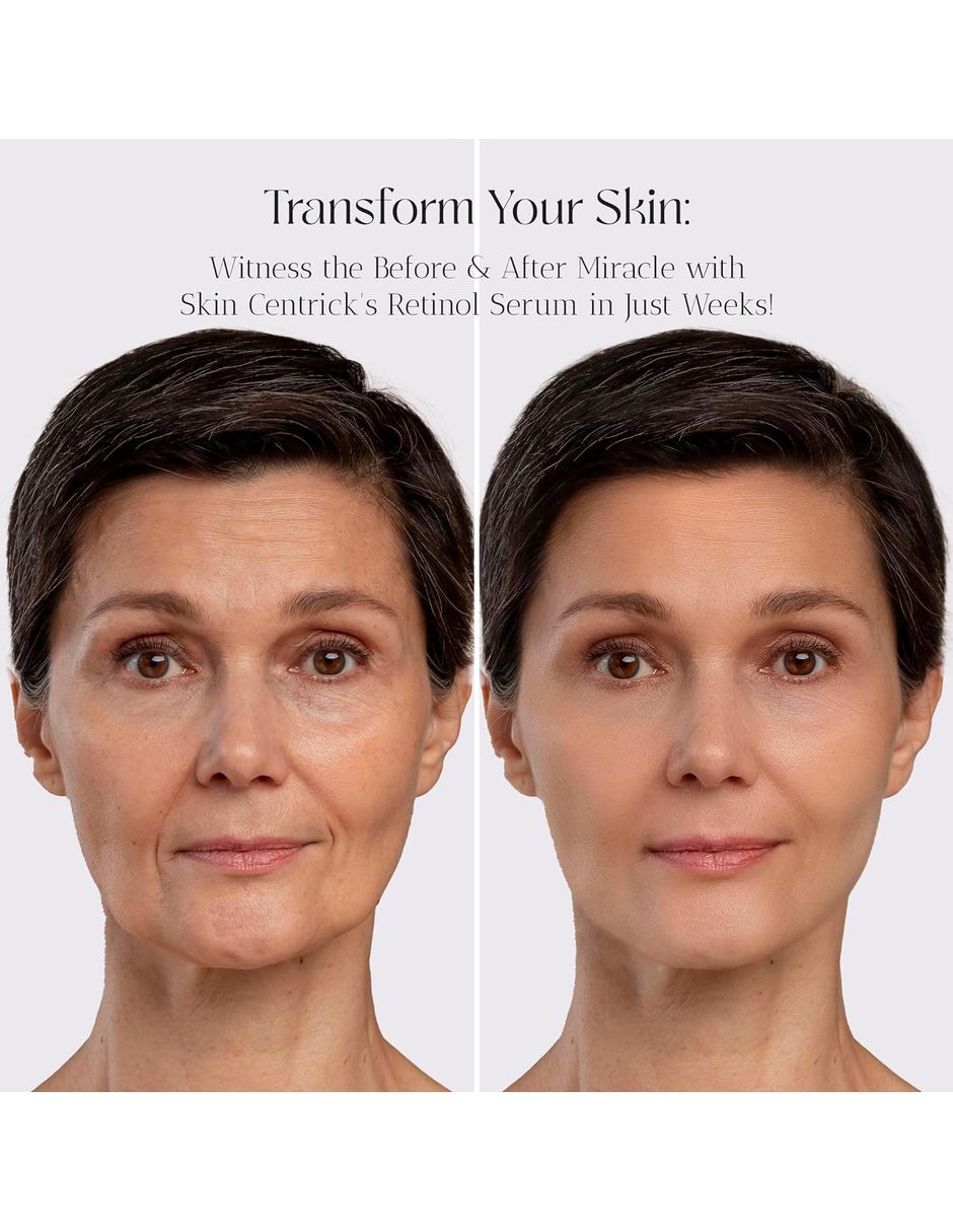 Sérum regenerador facial de retinol de todo tipo de piel 3