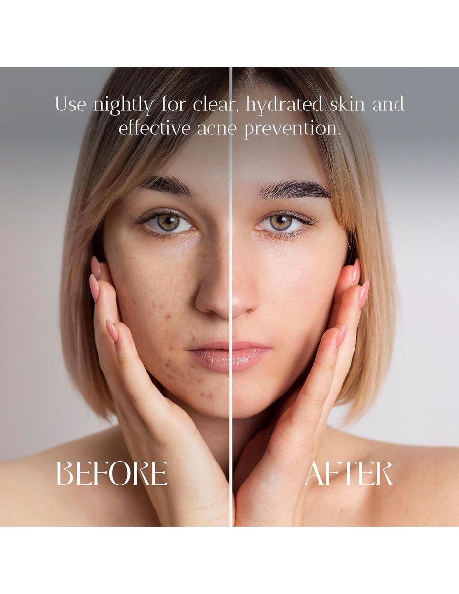 Crema hidratante de noche para el acné Skin Centrick
