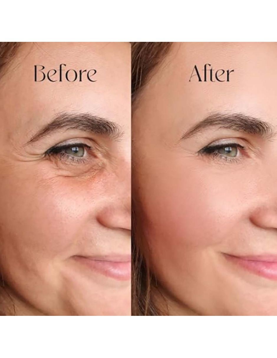 Sérum hidratante facial suero de ácido hialurónico de todo tipo de piel 2