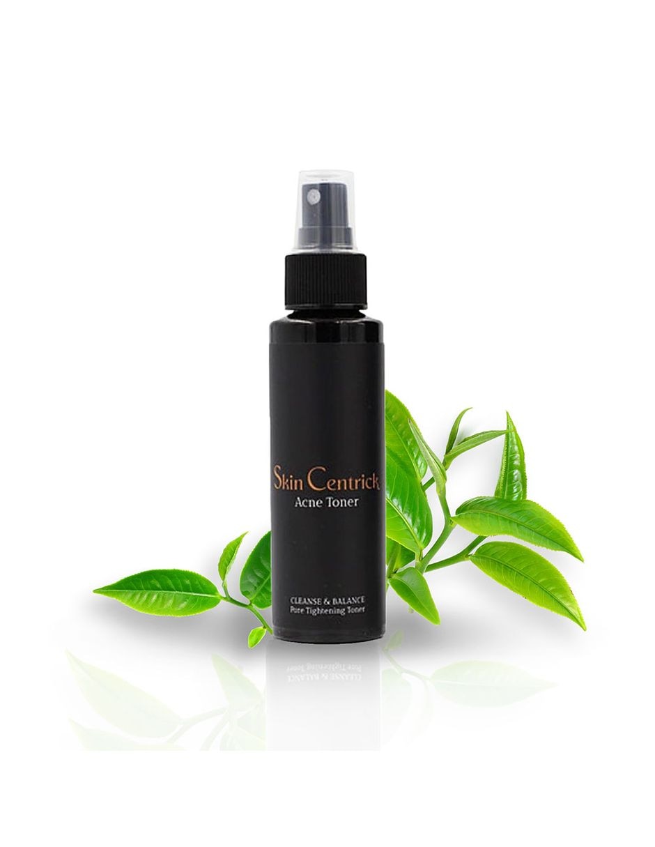 Tónico facial para el acné 1
