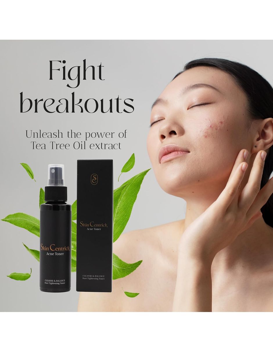 Tónico facial para el acné 2