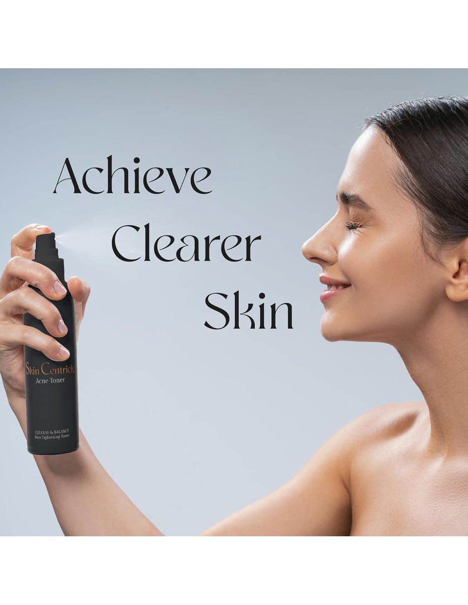 Tónico facial para el acné 3