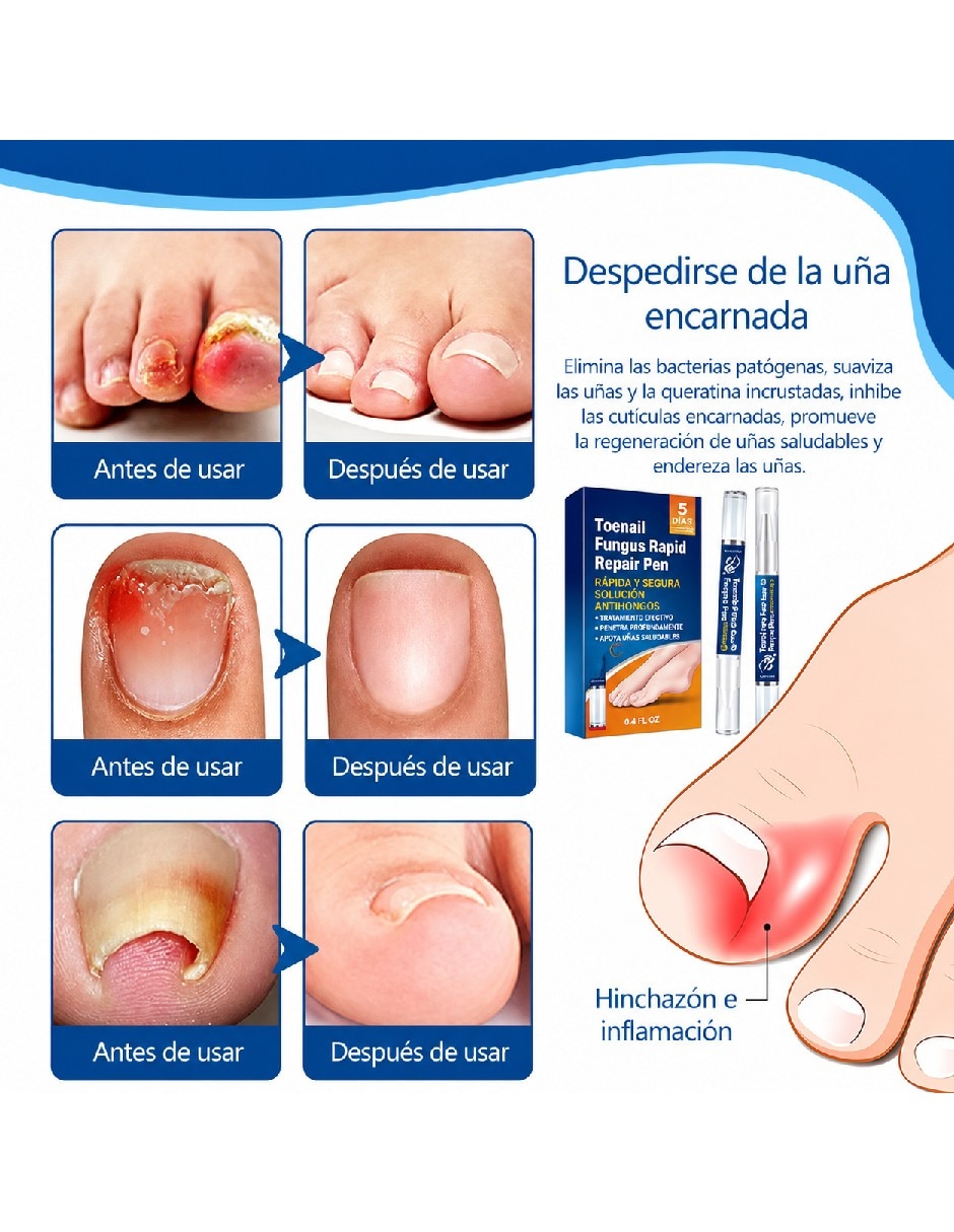 Antimicóticos 4