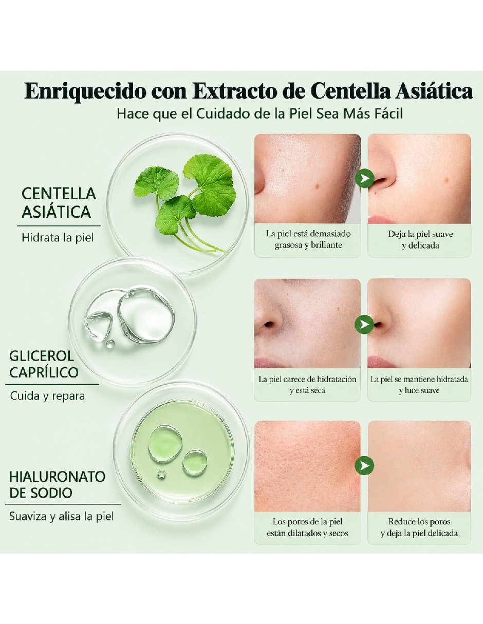Tratamiento facial kit antiacné cuidado de la piel 3