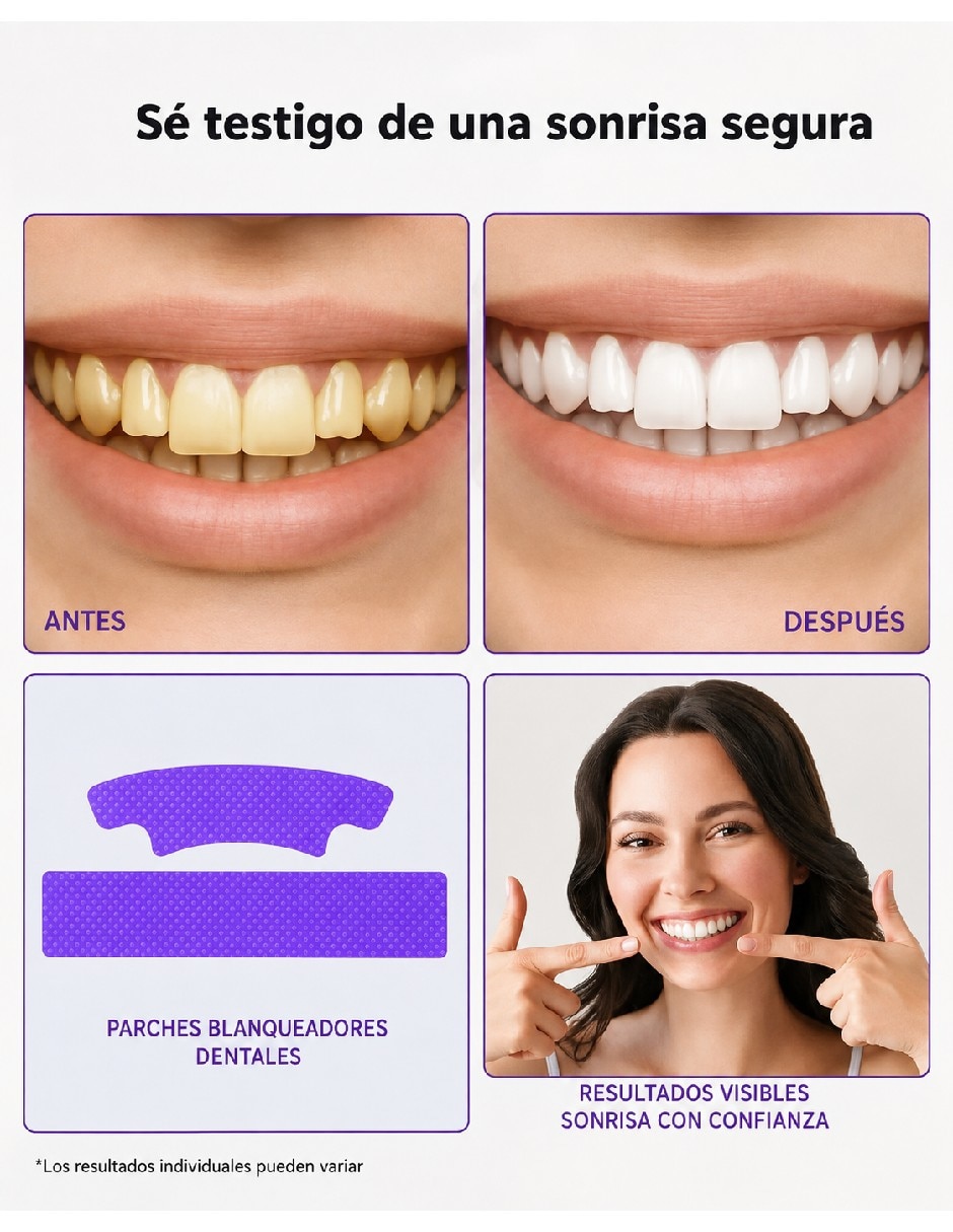 Blanqueador dental 3