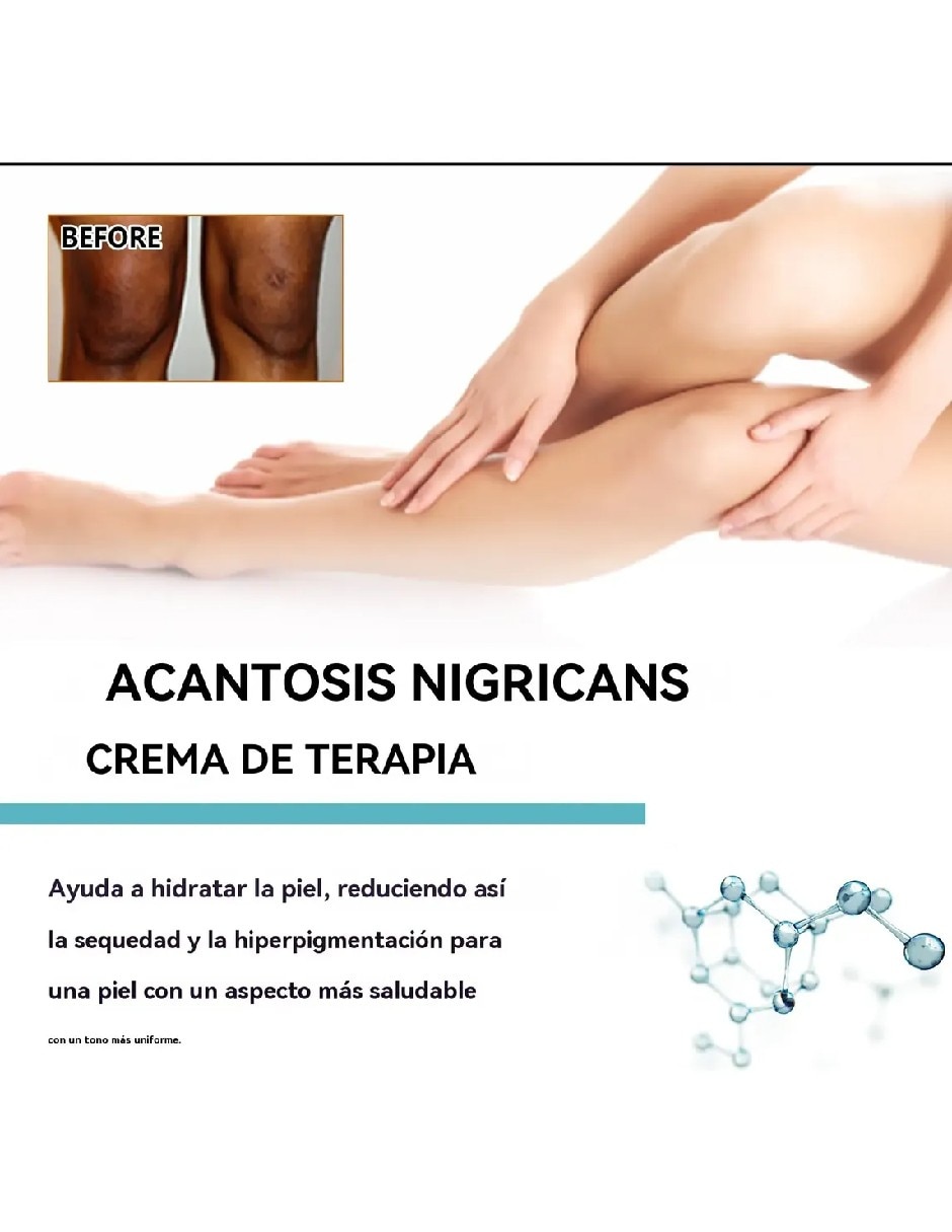 Crema para cuerpo recomendada para aclarar de día y noche para todo tipo piel 4