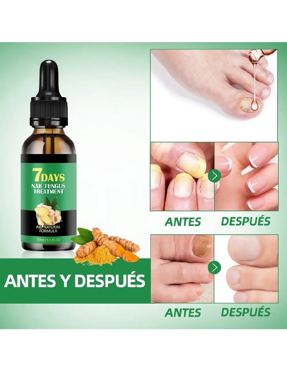 Antimicóticos 3