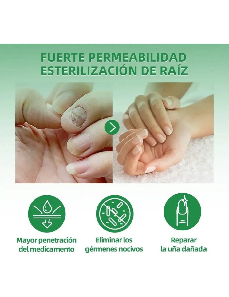 Antimicóticos 4