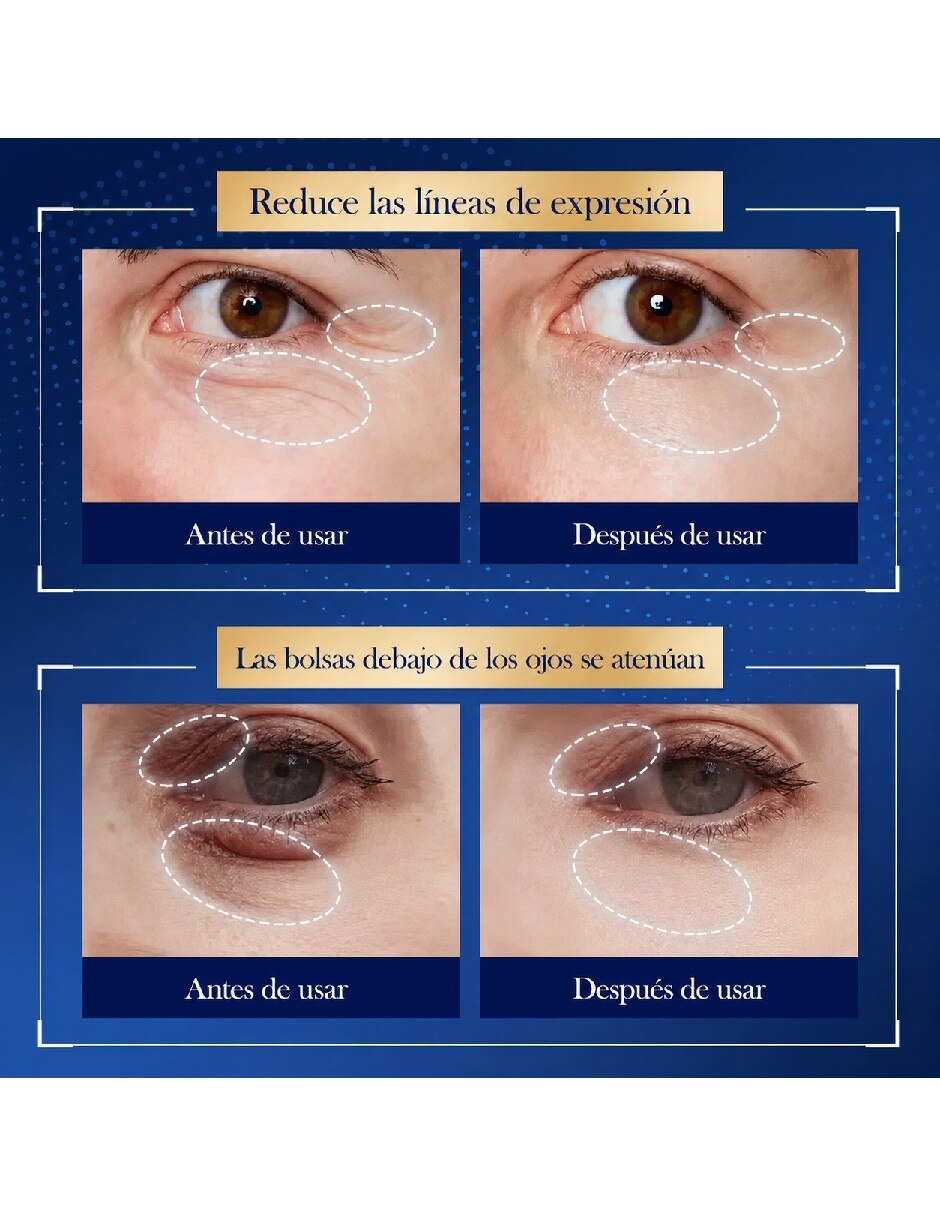 Crema para contorno de ojos recomendada para bolsas y ojeras día y noche todo tipo de piel 3