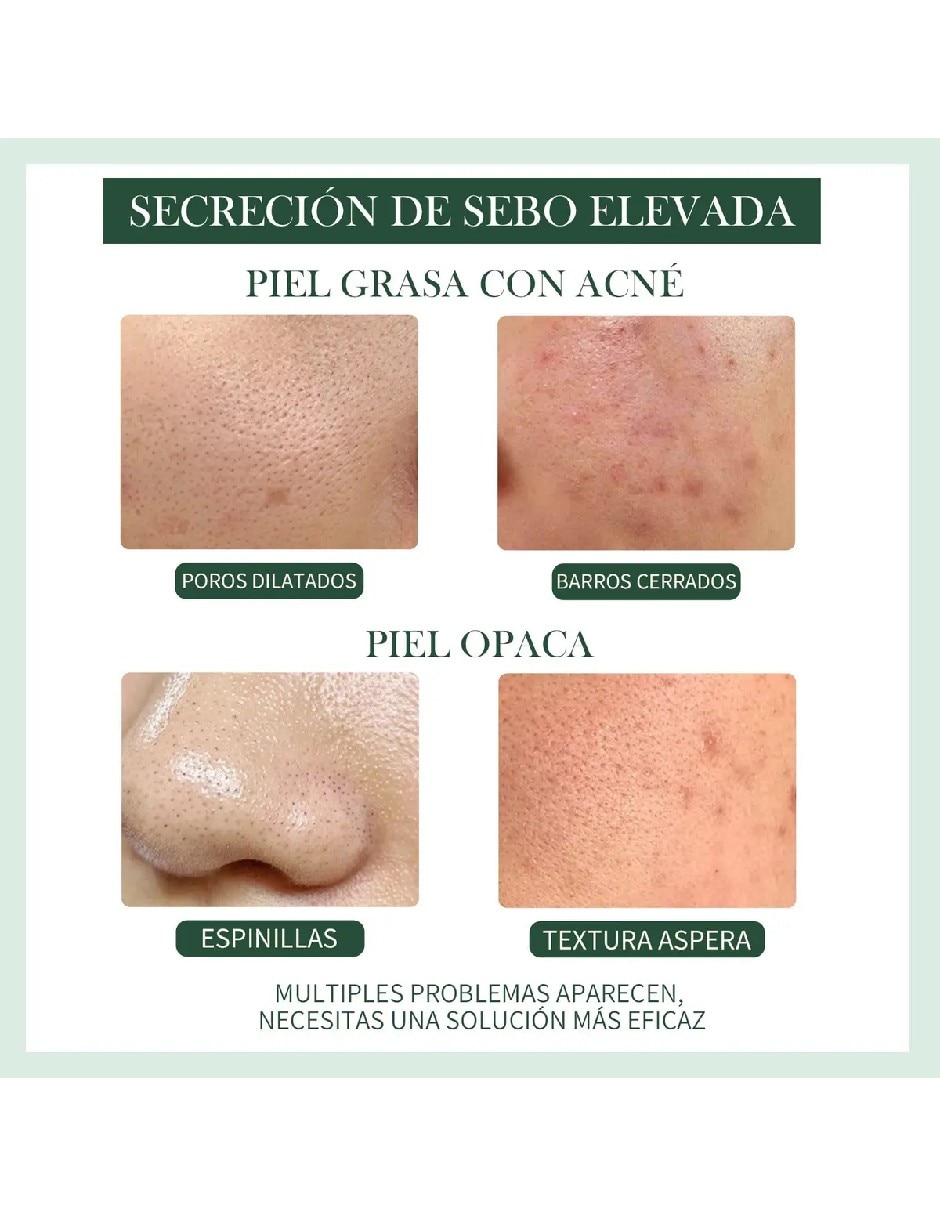Sérum facial Ácido Láctico y Hialurónico de piel mixta 2