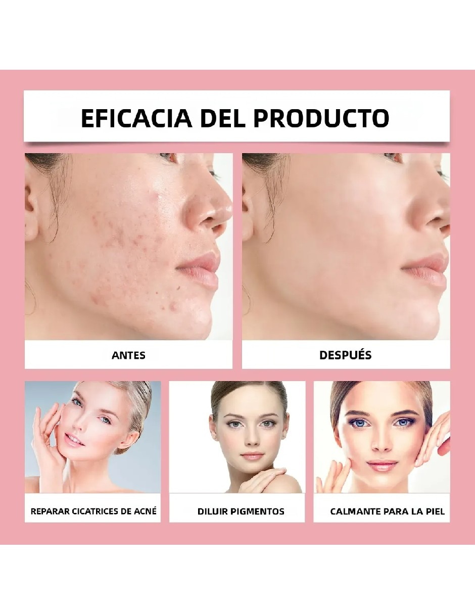 Sérum antiacné facial con niacinamida de todo tipo de piel 2