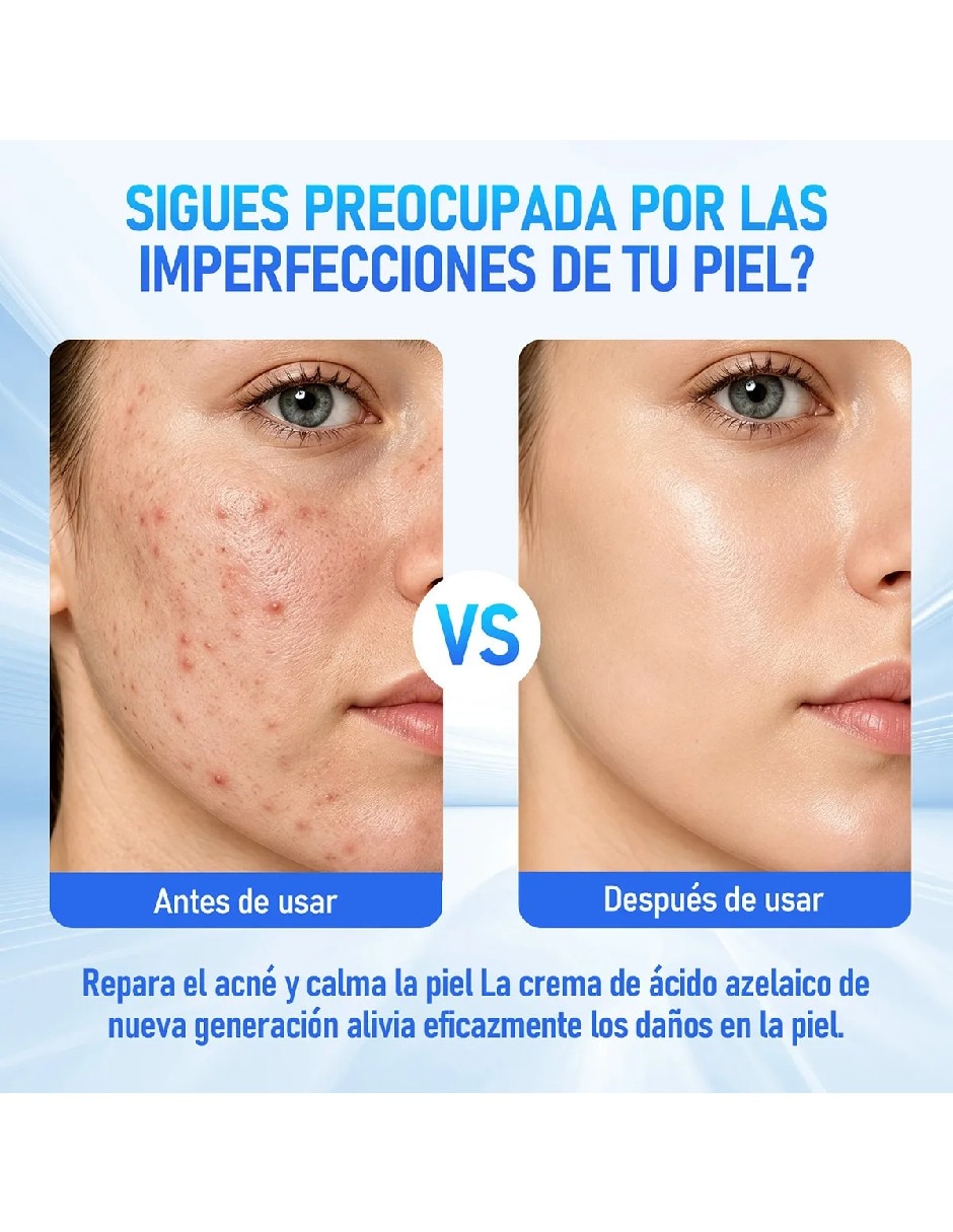 Set crema facial recomendada para desinflamar y relajar de día y noche para todo tipo de piel 3