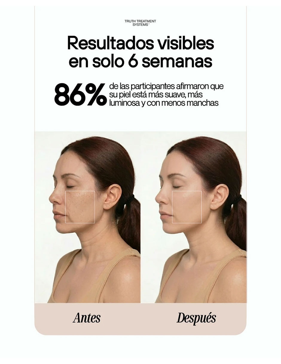 Máscara facial led 4